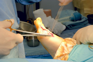 doctor performing operation on foot